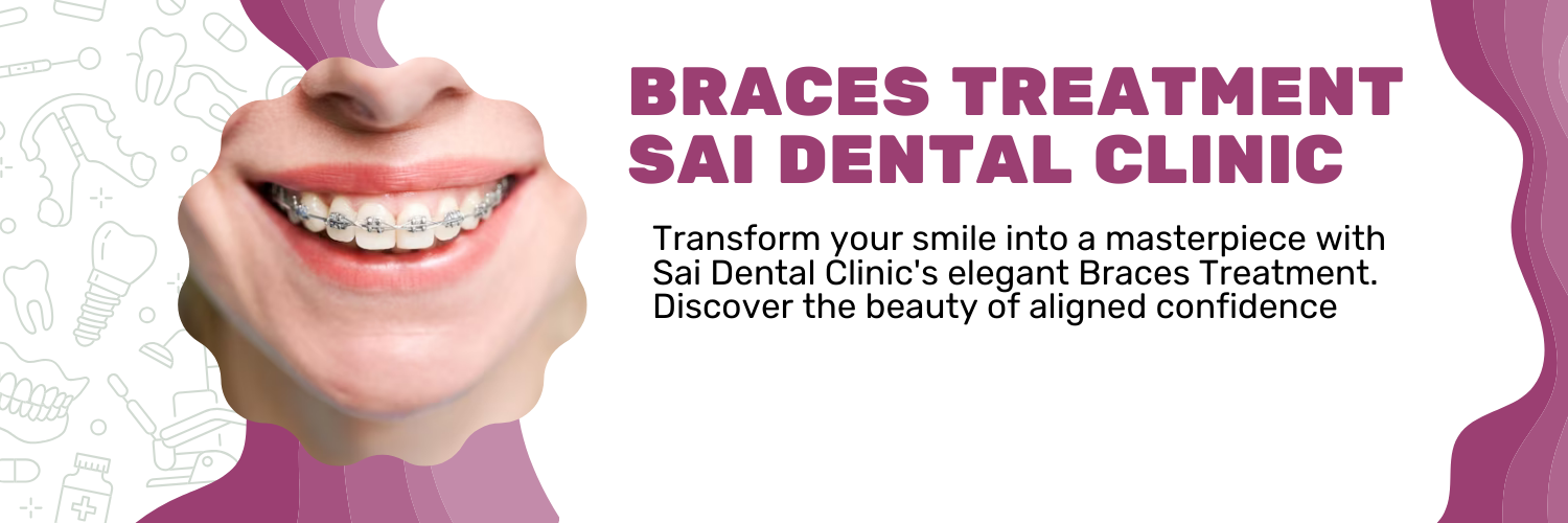 Braces Treatment in Pimpri Chinchwad Dr Lokhande Dental Clinic